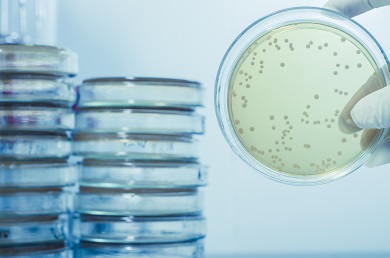 Agar Plate